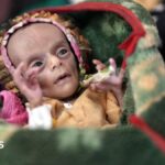 Newborn twins fight for survival as conflict fuels Yemen’s hunger crisis