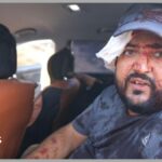 Palestinians and US journalist injured by Israeli settlers in West Bank harvest attack