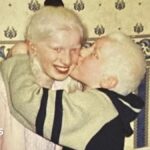 ‘Albinism means you are never invisible’, say Coventry siblings